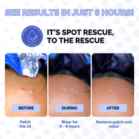 Spot Rescue Blemish Patches
