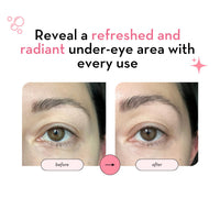 Under Eye Patches with 24K Gold