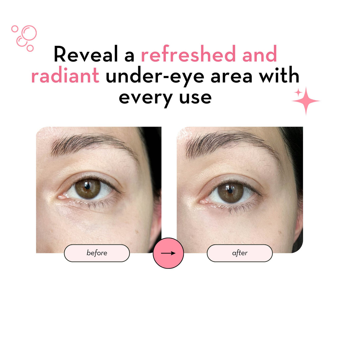 Under Eye Patches with 24K Gold