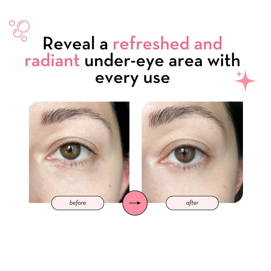 Under Eye Patches with 24K Gold
